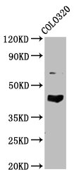 GNAL Antibody - Western Blot Positive WB detected in: COLO320 whole cell lysate All Lanes: GNAL antibody at 4.8µg/ml Secondary Goat polyclonal to rabbit IgG at 1/50000 dilution Predicted band size: 45, 53, 21 KDa Observed band size: 45 KDa