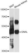 GNAL Antibody - Western blot analysis of extracts of various cell lines, using GNAL antibody at 1:3000 dilution. The secondary antibody used was an HRP Goat Anti-Rabbit IgG (H+L) at 1:10000 dilution. Lysates were loaded 25ug per lane and 3% nonfat dry milk in TBST was used for blocking. An ECL Kit was used for detection and the exposure time was 30s.