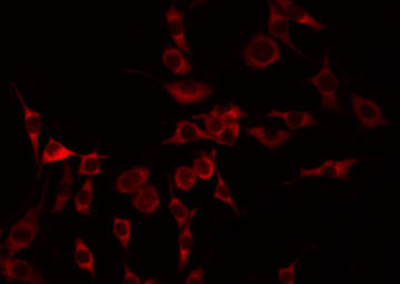 GNAL Antibody - Staining LOVO cells by IF/ICC. The samples were fixed with PFA and permeabilized in 0.1% Triton X-100, then blocked in 10% serum for 45 min at 25°C. The primary antibody was diluted at 1:200 and incubated with the sample for 1 hour at 37°C. An Alexa Fluor 594 conjugated goat anti-rabbit IgG (H+L) Ab, diluted at 1/600, was used as the secondary antibody.