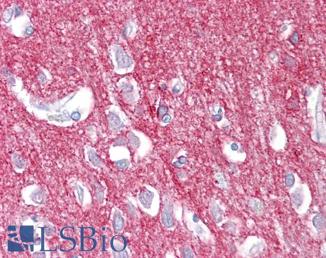 GNAO1 Antibody - Human Brain, Cortex: Formalin-Fixed, Paraffin-Embedded (FFPE).  This image was taken for the unconjugated form of this product. Other forms have not been tested.