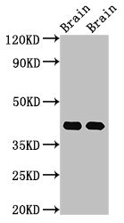 GNAO1 Antibody - Western Blot Positive WB detected in: Rat brain tissue, Mouse brain tissue All lanes: Gnao1 antibody at 3µg/ml Secondary Goat polyclonal to rabbit IgG at 1/50000 dilution Predicted band size: 41 kDa Observed band size: 41 kDa