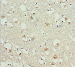 GNAO1 Antibody - Immunohistochemistry of paraffin-embedded human brain tissue at dilution 1:100