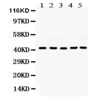 GNAQ Antibody - GNAQ antibody Western blot. All lanes: Anti GNAQ at 0.5 ug/ml. Lane 1: Rat Ovary Tissue Lysate at 50 ug. Lane 2: Rat Testis Tissue Lysate at 50 ug. Lane 3: Mouse Testis Tissue Lysate at 50 ug. Lane 4: 22RV1 Whole Cell Lysate at 40 ug. Lane 5: SKOV Whole Cell Lysate at 40 ug. Predicted band size: 42 kD. Observed band size: 42 kD.