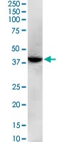 GNAQ Antibody - GNAQ monoclonal antibody (M04), clone 3B9. Western Blot analysis of GNAQ expression in Jurkat.
