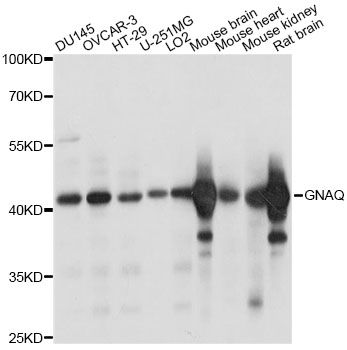 GNAQ Antibody - Western blot analysis of extracts of various cell lines, using GNAQ antibody at 1:1000 dilution. The secondary antibody used was an HRP Goat Anti-Rabbit IgG (H+L) at 1:10000 dilution. Lysates were loaded 25ug per lane and 3% nonfat dry milk in TBST was used for blocking. An ECL Kit was used for detection and the exposure time was 1s.