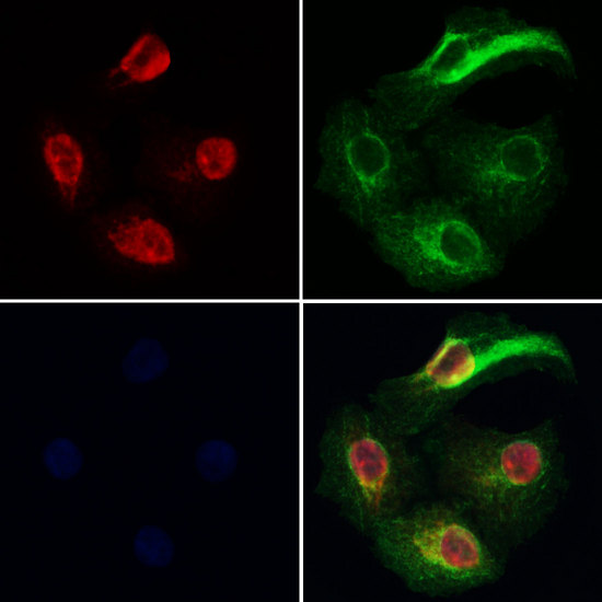 GNAQ Antibody - Staining HeLa cells by IF/ICC. The samples were fixed with PFA and permeabilized in 0.1% Triton X-100, then blocked in 10% serum for 45 min at 25°C. Samples were then incubated with primary Ab(1:200) and mouse anti-beta tubulin Ab(1:200) for 1 hour at 37°C. An AlexaFluor594 conjugated goat anti-rabbit IgG(H+L) Ab(1:200 Red) and an AlexaFluor488 conjugated goat anti-mouse IgG(H+L) Ab(1:600 Green) were used as the secondary antibod