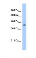 GNAS Antibody - Jurkat cell lysate. Antibody concentration: 1.25 ug/ml. Gel concentration: 12%.  This image was taken for the unconjugated form of this product. Other forms have not been tested.