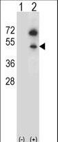 GNAS Antibody - Western blot of GNAS (arrow) using rabbit polyclonal GNAS Antibody. 293 cell lysates (2 ug/lane) either nontransfected (Lane 1) or transiently transfected (Lane 2) with the GNAS gene.