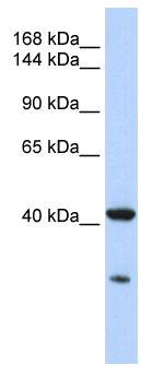 GNAS Antibody - Western blot of MCF7 cell lysate.