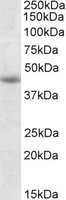 GNAS Antibody - GNAS antibody (1 ug/ml) staining of Jurkat lysate (35 ug protein/ml in RIPA buffer). Primary incubation was 1 hour. Detected by chemiluminescence.