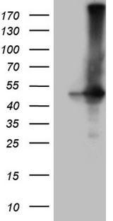 GNAS Antibody - HEK293T cells were transfected with the pCMV6-ENTRY control. (Left lane) or pCMV6-ENTRY GNAS. (Right lane) cDNA for 48 hrs and lysed. Equivalent amounts of cell lysates. (5 ug per lane) were separated by SDS-PAGE and immunoblotted with anti-GNAS. (1:2000)