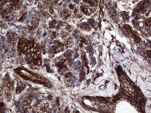 GNAS Antibody - Immunohistochemical staining of paraffin-embedded Human pancreas tissue within the normal limits using anti-GNAS mouse monoclonal antibody. (Heat-induced epitope retrieval by 1mM EDTA in 10mM Tris buffer. (pH8.5) at 120°C for 3 min. (1:2000)