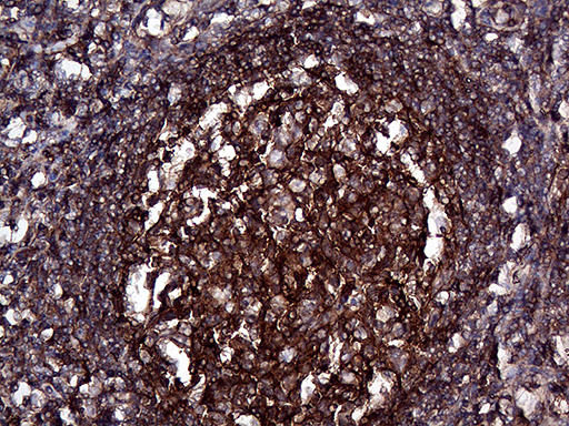 GNAS Antibody - Immunohistochemical staining of paraffin-embedded Human lymph node tissue within the normal limits using anti-GNAS mouse monoclonal antibody. (Heat-induced epitope retrieval by 1mM EDTA in 10mM Tris buffer. (pH8.5) at 120°C for 3 min. (1:2000)