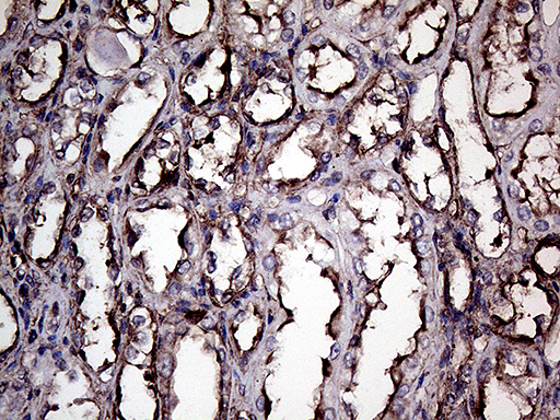 GNAS Antibody - Immunohistochemical staining of paraffin-embedded Human Kidney tissue within the normal limits using anti-GNAS mouse monoclonal antibody. (Heat-induced epitope retrieval by 1mM EDTA in 10mM Tris buffer. (pH8.5) at 120°C for 3 min. (1:2000)