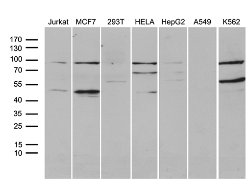 GNAS Antibody - Western blot analysis of extracts. (35ug) from 7 different cell lines by using anti-GNAS monoclonal antibody. (1:500)