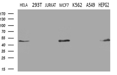 GNAS Antibody - Western blot analysis of extracts. (35ug) from 7 different cell lines by using anti-GNAS monoclonal antibody. (1:500)