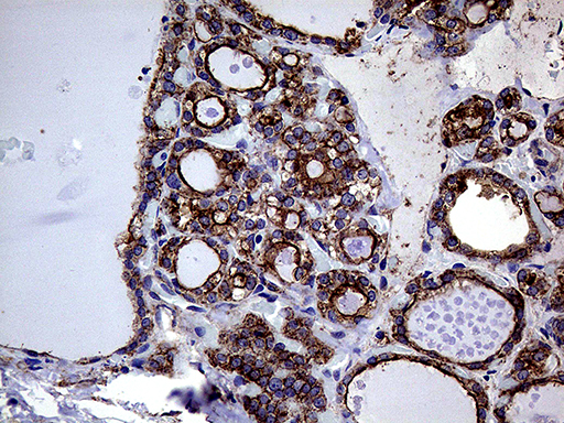 GNAS Antibody - Immunohistochemical staining of paraffin-embedded Human thyroid tissue within the normal limits using anti-GNAS mouse monoclonal antibody. (Heat-induced epitope retrieval by 1mM EDTA in 10mM Tris buffer. (pH8.5) at 120°C for 3 min. (1:500)