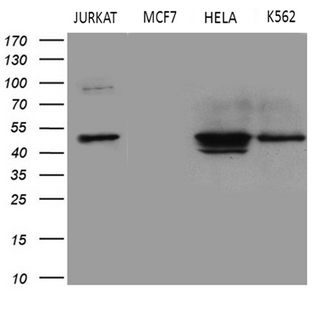 GNAS Antibody - Western blot analysis of extracts. (35ug) from 4 different cell lines by using anti-GNAS monoclonal antibody. (1:500)