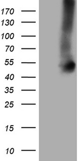 GNAS Antibody - HEK293T cells were transfected with the pCMV6-ENTRY control. (Left lane) or pCMV6-ENTRY GNAS. (Right lane) cDNA for 48 hrs and lysed. Equivalent amounts of cell lysates. (5 ug per lane) were separated by SDS-PAGE and immunoblotted with anti-GNAS. (1:2000)