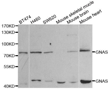 GNAS Antibody - Western blot analysis of extracts of various cell lines, using GNAS antibody.