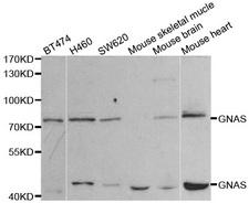 GNAS Antibody - Western blot analysis of extracts of various cell lines, using GNAS antibody.