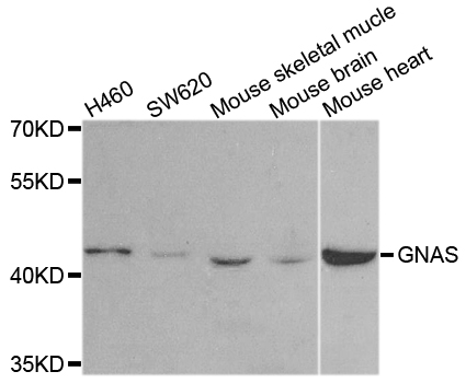 GNAS Antibody - Western blot analysis of extracts of various cell lines.