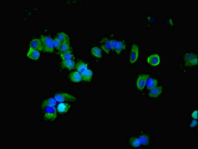 GNAS Antibody - Immunofluorescent analysis of MCF-7 cells using GNAS Antibody at dilution of 1:100 and Alexa Fluor 488-congugated AffiniPure Goat Anti-Rabbit IgG(H+L)
