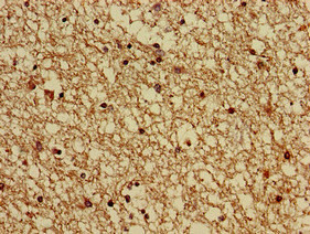GNAS Antibody - Immunohistochemistry of paraffin-embedded human brain tissue using GNAS Antibody at dilution of 1:100