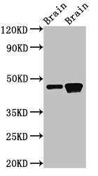 GNAS Antibody - Western Blot Positive WB detected in: Rat brain tissue, Mouse brain tissue All lanes: GNAS antibody at 3µg/ml Secondary Goat polyclonal to rabbit IgG at 1/50000 dilution Predicted band size: 46, 45, 112 kDa Observed band size: 46 kDa