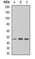 GNAS Antibody - Western blot analysis of GNAS expression in SW620 (A); mouse brain (B); mouse heart (C) whole cell lysates.