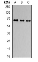 GNAS Antibody - Western blot analysis of GNAS expression in BT474 (A); SW260 (B); Raji (C) whole cell lysates.