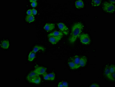 GNAS Antibody - Immunofluorescence staining of MCF-7 cells at a dilution of 1:200, counter-stained with DAPI. The cells were fixed in 4% formaldehyde, permeabilized using 0.2% Triton X-100 and blocked in 10% normal Goat Serum. The cells were then incubated with the antibody overnight at 4 °C.The secondary antibody was Alexa Fluor 488-congugated AffiniPure Goat Anti-Rabbit IgG (H+L) .