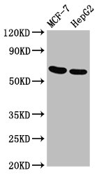 GNAS Antibody - Positive Western Blot detected in MCF-7 whole cell lysate, HepG2 whole cell lysate. All lanes: GNAS antibody at 3.4 µg/ml Secondary Goat polyclonal to rabbit IgG at 1/50000 dilution. Predicted band size: 68 KDa. Observed band size: 68 KDa