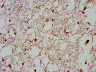 GNAS Antibody - IHC image of GNAS Antibody diluted at 1:600 and staining in paraffin-embedded human brain tissue performed on a Leica BondTM system. After dewaxing and hydration, antigen retrieval was mediated by high pressure in a citrate buffer (pH 6.0). Section was blocked with 10% normal goat serum 30min at RT. Then primary antibody (1% BSA) was incubated at 4°C overnight. The primary is detected by a biotinylated secondary antibody and visualized using an HRP conjugated SP system.