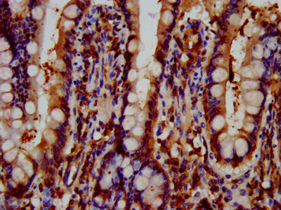 GNAS Antibody - IHC image of GNAS Antibody diluted at 1:600 and staining in paraffin-embedded human small intestine tissue performed on a Leica BondTM system. After dewaxing and hydration, antigen retrieval was mediated by high pressure in a citrate buffer (pH 6.0). Section was blocked with 10% normal goat serum 30min at RT. Then primary antibody (1% BSA) was incubated at 4°C overnight. The primary is detected by a biotinylated secondary antibody and visualized using an HRP conjugated SP system.