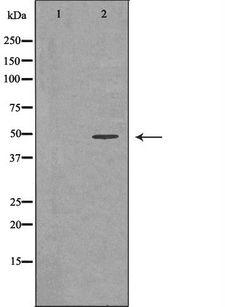 GNAS Antibody - Western blot analysis of extracts of mouse brain tissue using GNAS antibody. The lane on the left is treated with the antigen-specific peptide.