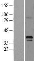 GNAS Protein - Western validation with an anti-DDK antibody * L: Control HEK293 lysate R: Over-expression lysate