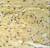 GNAT1 Antibody - GNAT1 Antibody IHC of formalin-fixed and paraffin-embedded mouse heart tissue followed by peroxidase-conjugated secondary antibody and DAB staining.