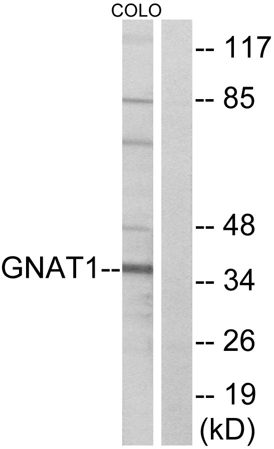 GNAT1 Antibody - Western blot analysis of lysates from COLO cells, using GNAT1 Antibody. The lane on the right is blocked with the synthesized peptide.