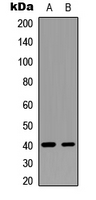 GNAT1 Antibody - Western blot analysis of GNAT1 expression in U87MG (A); mouse brain (B) whole cell lysates.