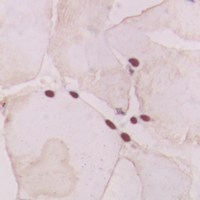 GNAT1 Antibody - Immunohistochemical analysis of GNAT1 staining in human heart formalin fixed paraffin embedded tissue section. The section was pre-treated using heat mediated antigen retrieval with sodium citrate buffer (pH 6.0). The section was then incubated with the antibody at room temperature and detected using an HRP conjugated compact polymer system. DAB was used as the chromogen. The section was then counterstained with hematoxylin and mounted with DPX.