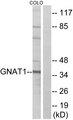 GNAT1 Antibody - Western blot analysis of extracts from COLO cells, using GNAT1 antibody.