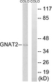 GNAT2 Antibody - Western blot analysis of lysates from COLO cells, using GNAT2 Antibody. The lane on the right is blocked with the synthesized peptide.