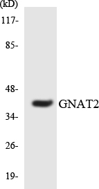 GNAT2 Antibody - Western blot analysis of the lysates from Jurkat cells using GNAT2 antibody.