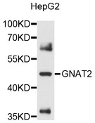 GNAT2 Antibody - Western blot analysis of extracts of HepG2 cells, using GNAT2 antibody at 1:1000 dilution. The secondary antibody used was an HRP Goat Anti-Rabbit IgG (H+L) at 1:10000 dilution. Lysates were loaded 25ug per lane and 3% nonfat dry milk in TBST was used for blocking. An ECL Kit was used for detection and the exposure time was 15s.