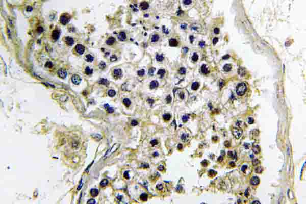 GNAT2 Antibody - IHC of G t2 (V34) pAb in paraffin-embedded human testis tissue.