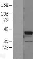 GNAT2 Protein - Western validation with an anti-DDK antibody * L: Control HEK293 lysate R: Over-expression lysate