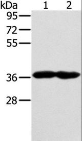 GNAT3 / Gustducin Antibody - Western blot analysis of Mouse heart and muscle tissue, using GNAT3 Polyclonal Antibody at dilution of 1:400.