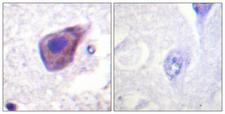 GNAZ Antibody - Immunohistochemistry analysis of paraffin-embedded human brain tissue, using Gz-alpha Antibody. The picture on the right is blocked with the synthesized peptide.