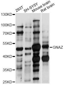 GNAZ Antibody - Western blot analysis of extracts of various cell lines, using GNAZ antibody at 1:1000 dilution. The secondary antibody used was an HRP Goat Anti-Rabbit IgG (H+L) at 1:10000 dilution. Lysates were loaded 25ug per lane and 3% nonfat dry milk in TBST was used for blocking. An ECL Kit was used for detection and the exposure time was 30s.